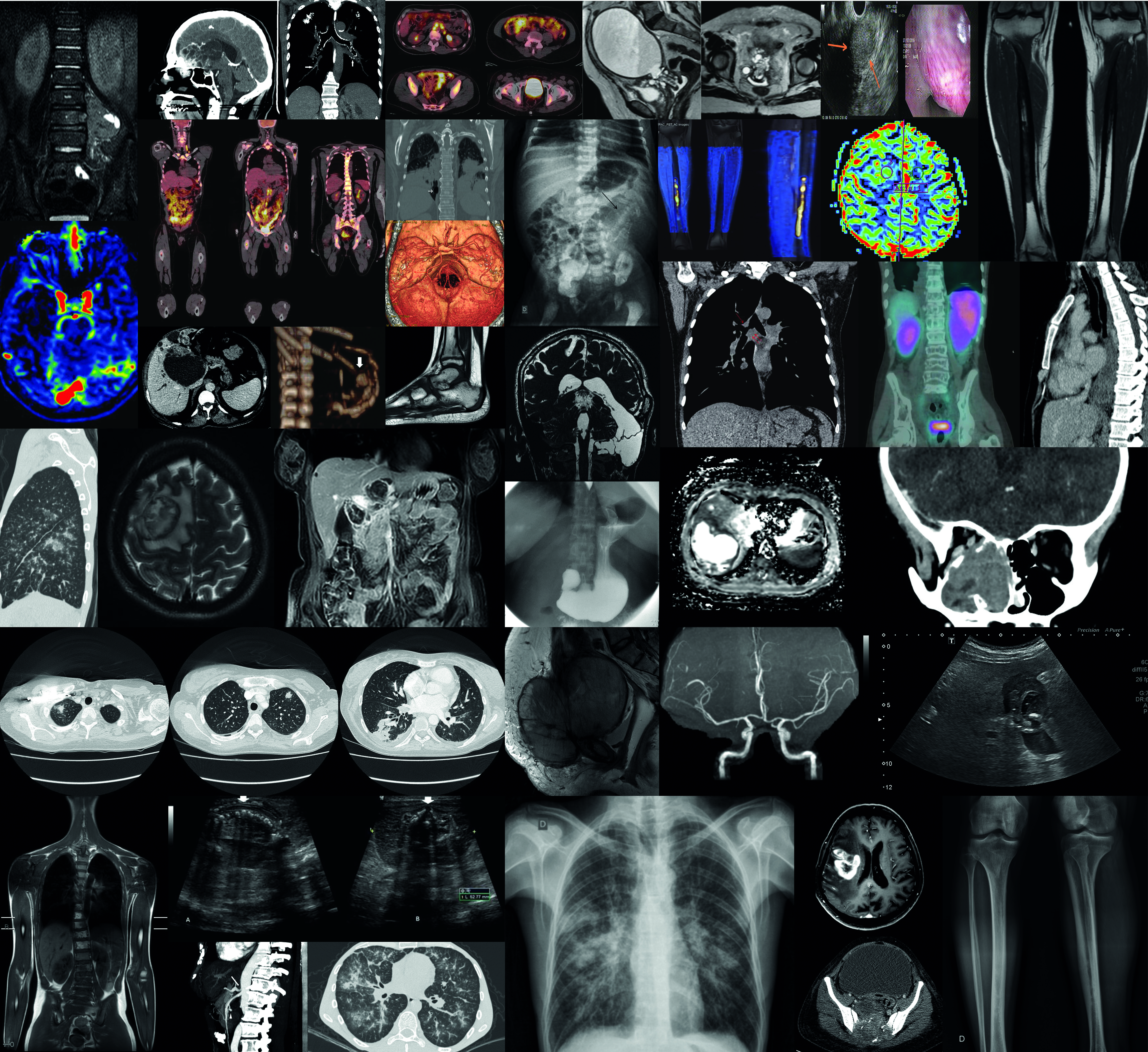 JPR 2019 - 49ª JORNADA PAULISTA DE RADIOLOGIA